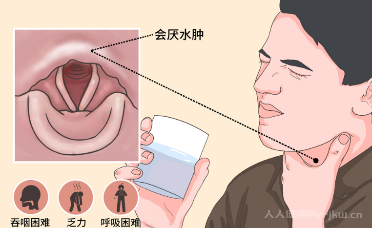 會(huì)厭炎是什么病