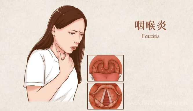 喉嚨發(fā)炎怎么快速消炎