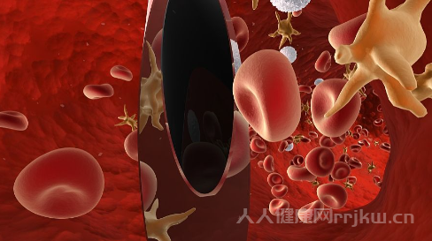 乳腺結(jié)節(jié)4a怎么判斷良性還是惡性