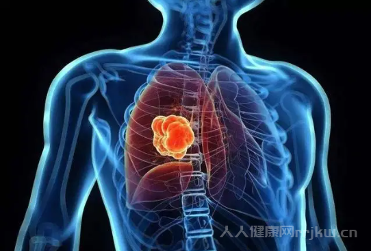 肺氣腫的表現(xiàn)與癥狀
