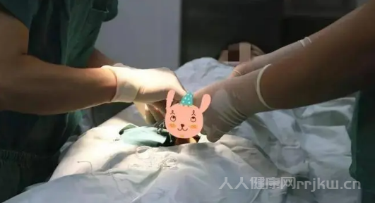 為什么男性要割包皮 割包皮有哪些好處?