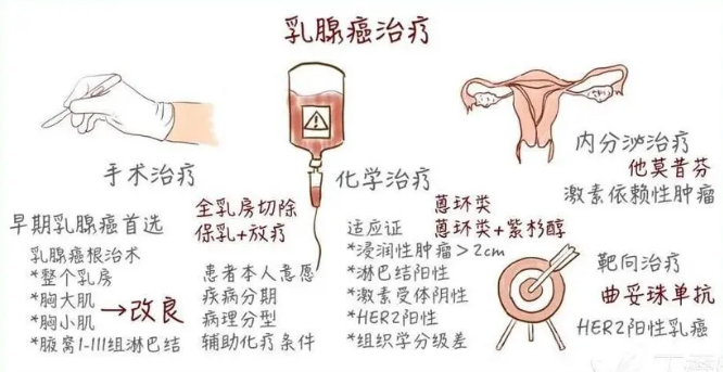 乳腺癌是怎樣引起的