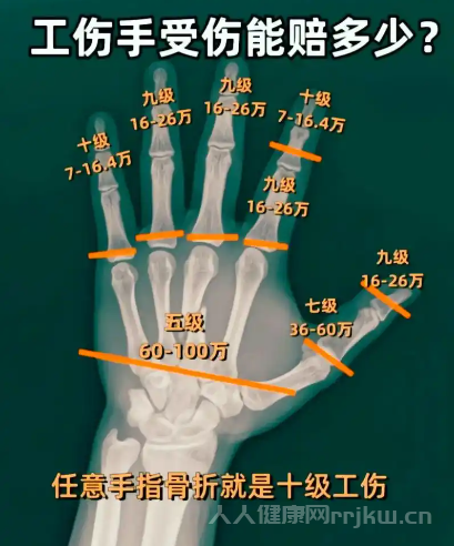 傷殘鑒定的結(jié)論一般有哪些？
