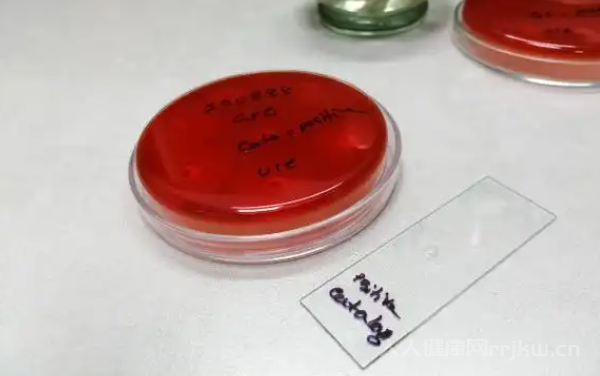 過氧化氫酶陽性是什么婦科疾病