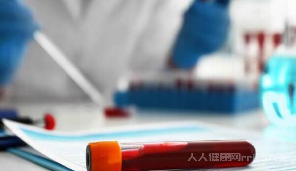 鐵蛋白高有什么癥狀和危害有哪些